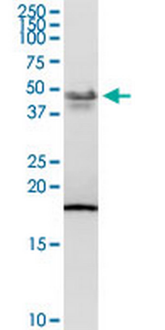 PCYT1B Antibody in Western Blot (WB)