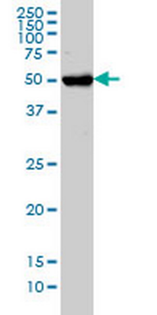 CHST3 Antibody in Western Blot (WB)