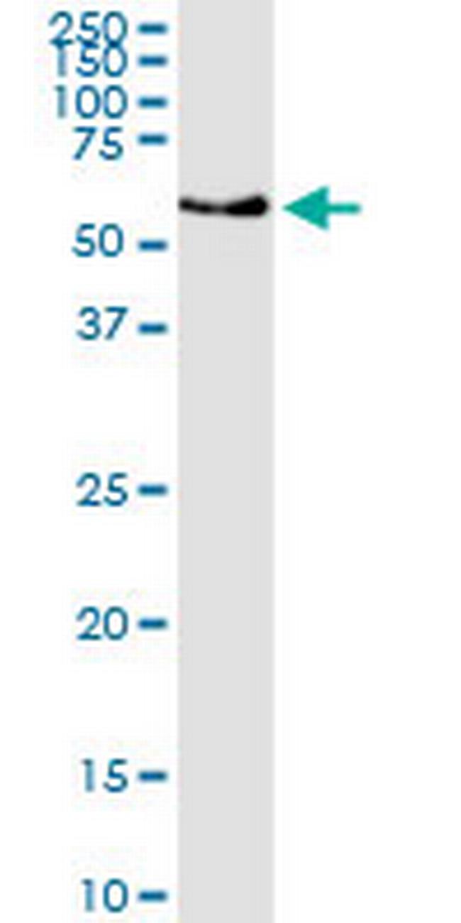 CHST3 Antibody in Western Blot (WB)