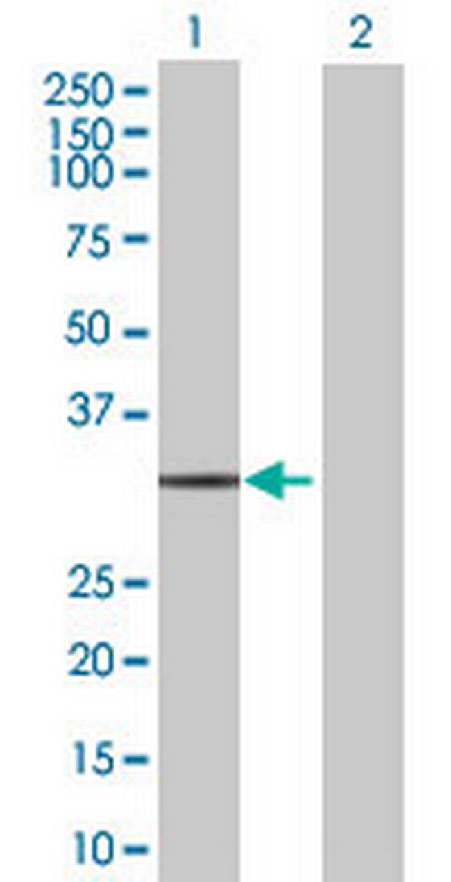 EIF4E2 Antibody in Western Blot (WB)