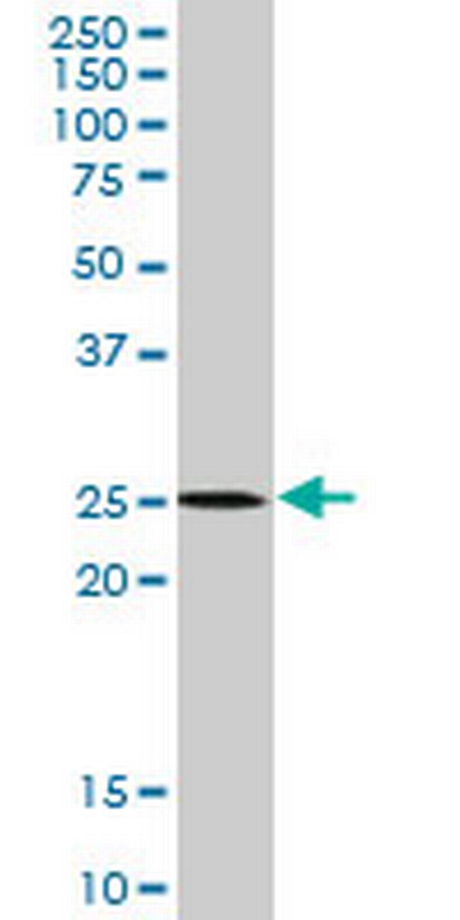 ATG5 Antibody in Western Blot (WB)