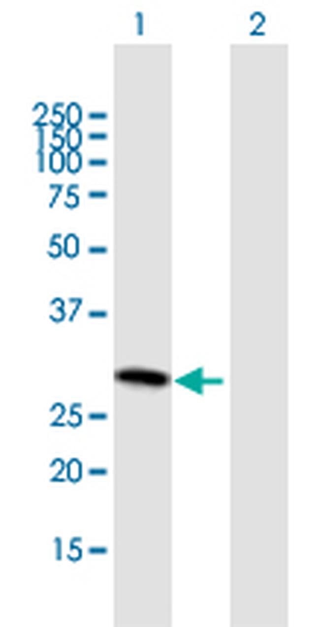 SLC25A27 Antibody in Western Blot (WB)