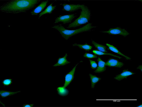 MAGED1 Antibody in Immunocytochemistry (ICC/IF)