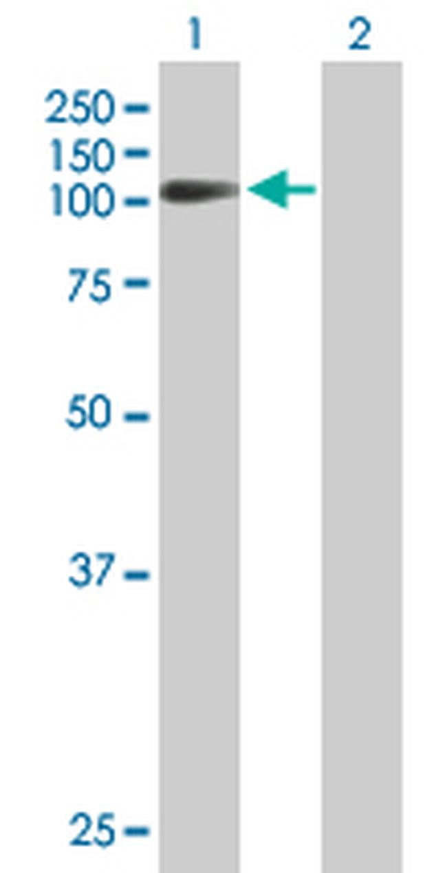 FXR2 Antibody in Western Blot (WB)