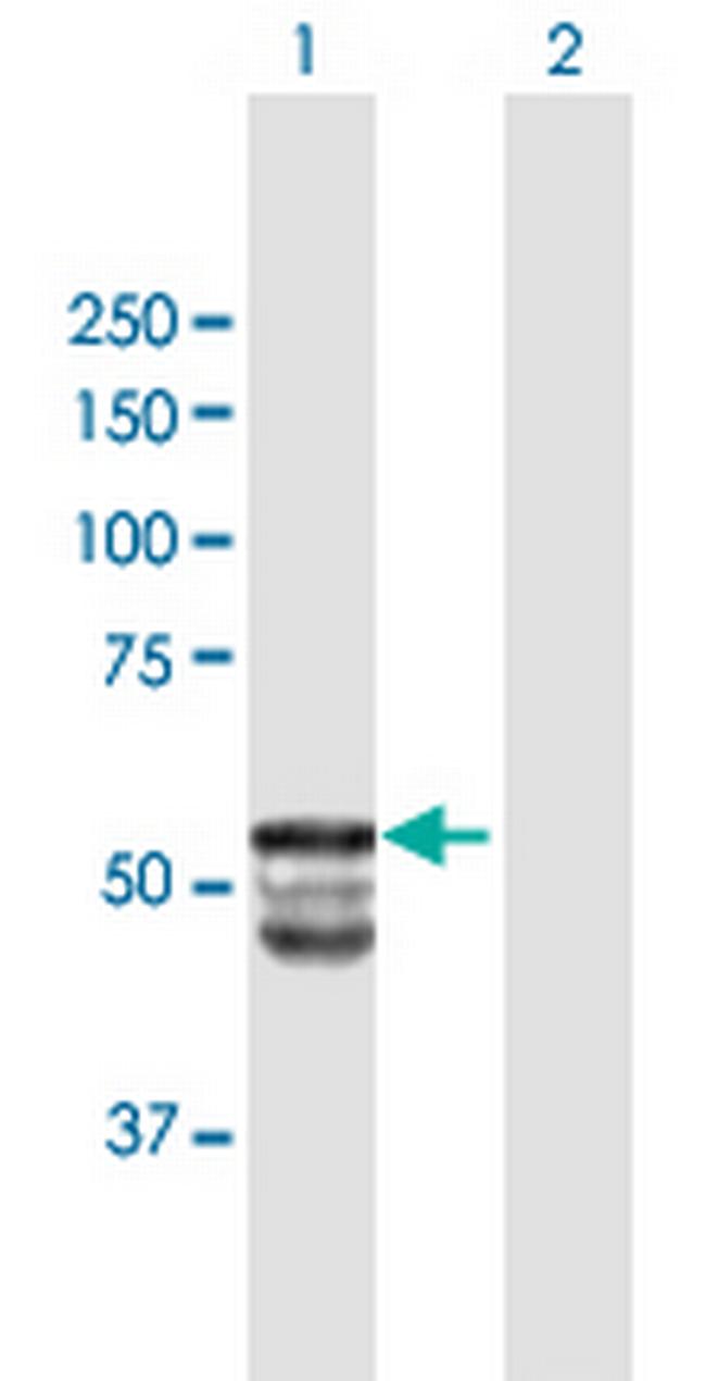 GAL3ST1 Antibody in Western Blot (WB)