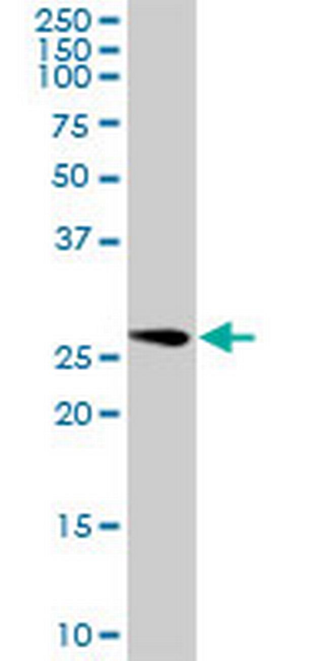 GOSR1 Antibody in Western Blot (WB)