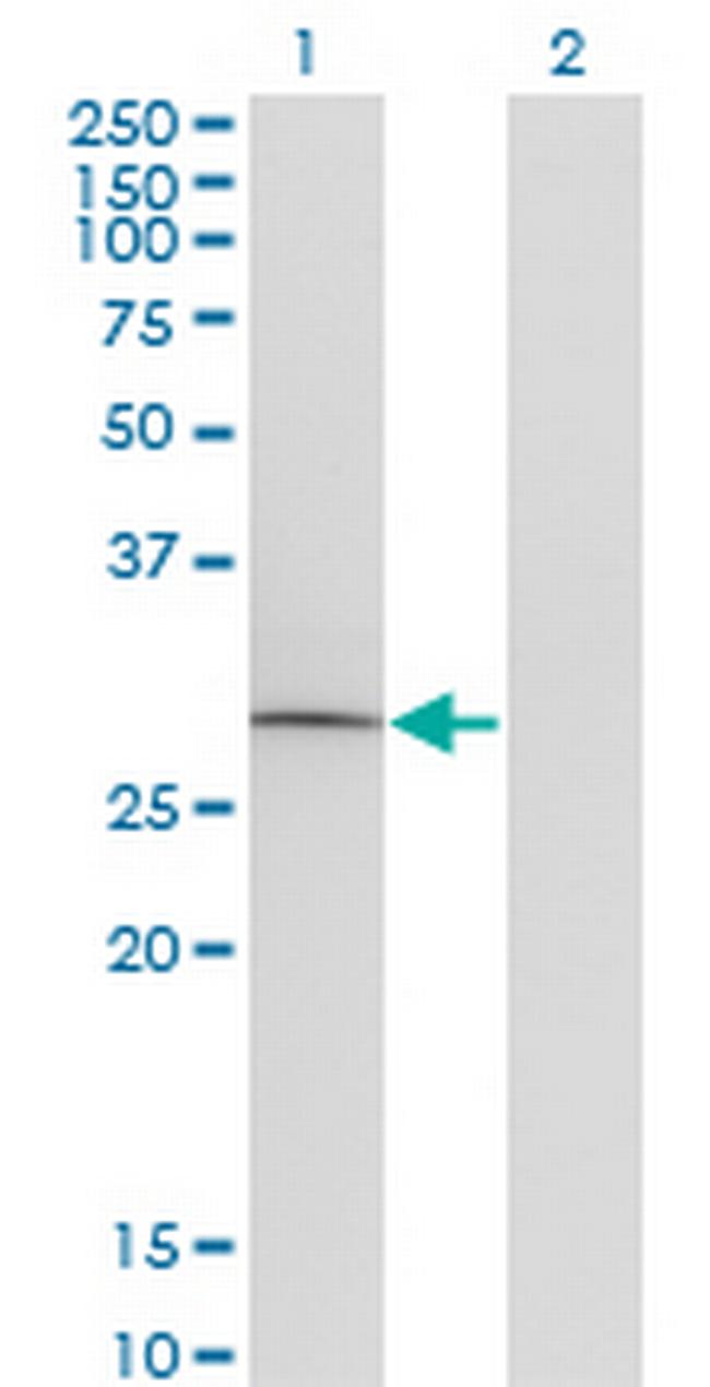 GOSR1 Antibody in Western Blot (WB)