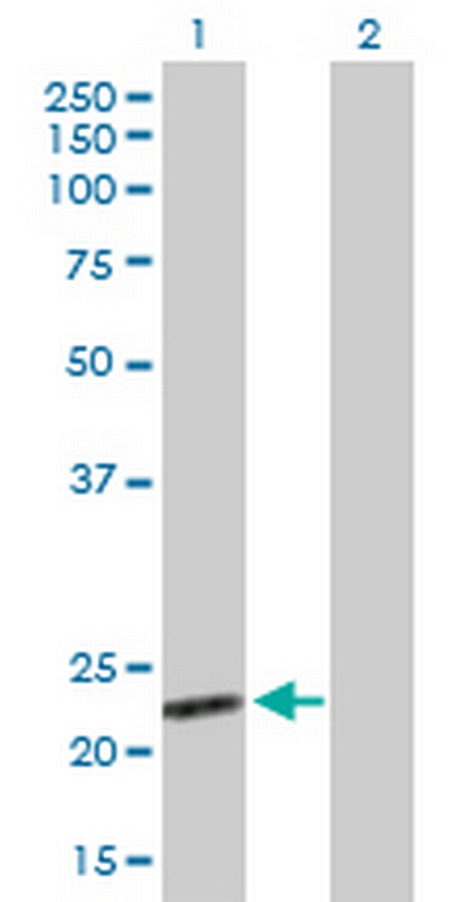 BAG2 Antibody in Western Blot (WB)