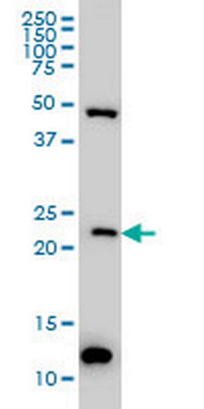 BAG2 Antibody in Western Blot (WB)