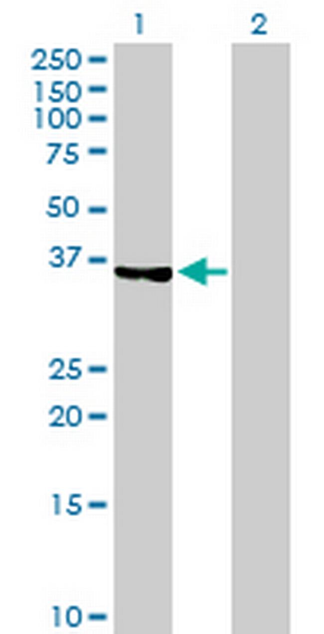 TP53I3 Antibody in Western Blot (WB)
