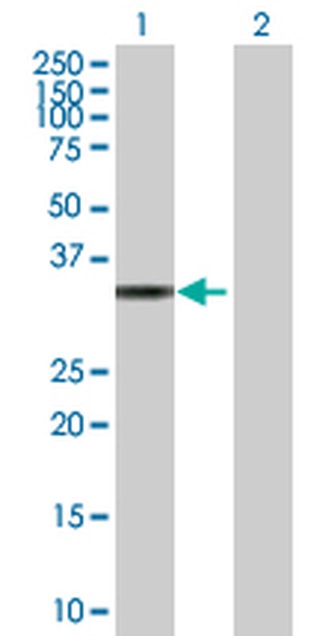 TP53I3 Antibody in Western Blot (WB)