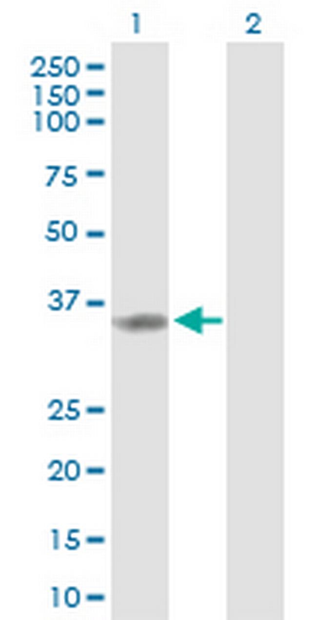 TP53I3 Antibody in Western Blot (WB)