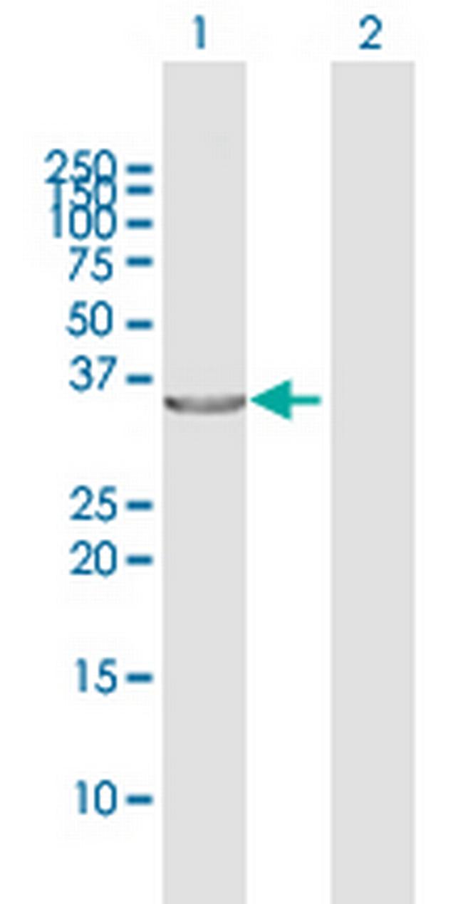 TP53I3 Antibody in Western Blot (WB)