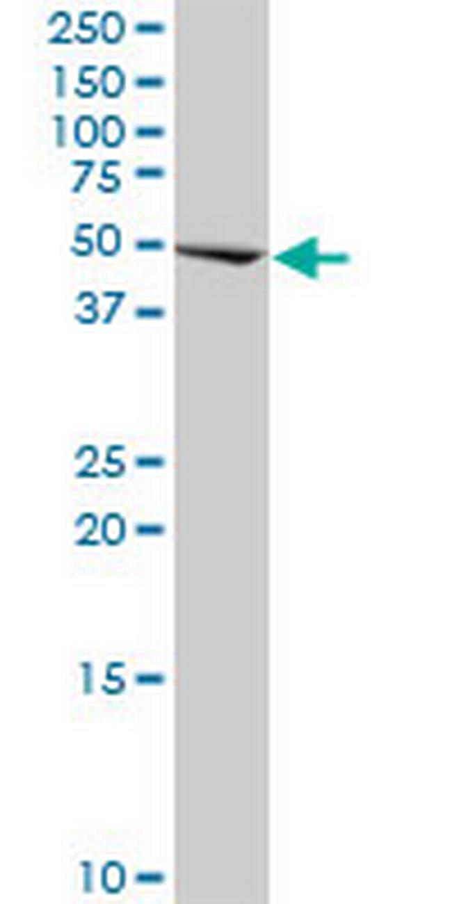 CIR Antibody in Western Blot (WB)