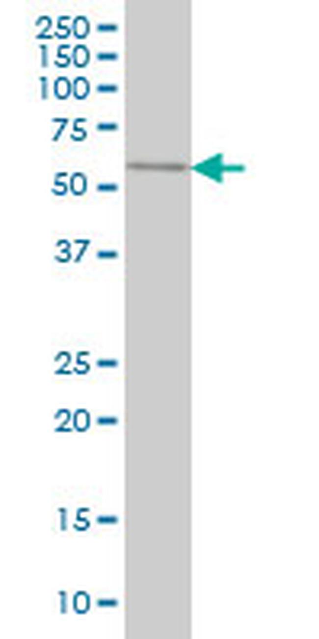SPAG6 Antibody in Western Blot (WB)
