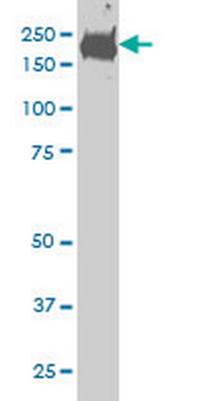 CDC42BPB Antibody in Western Blot (WB)