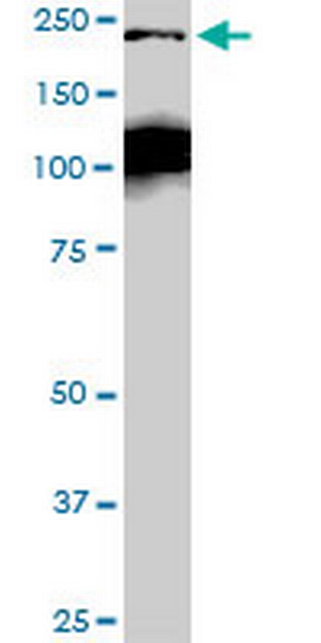 CDC42BPB Antibody in Western Blot (WB)