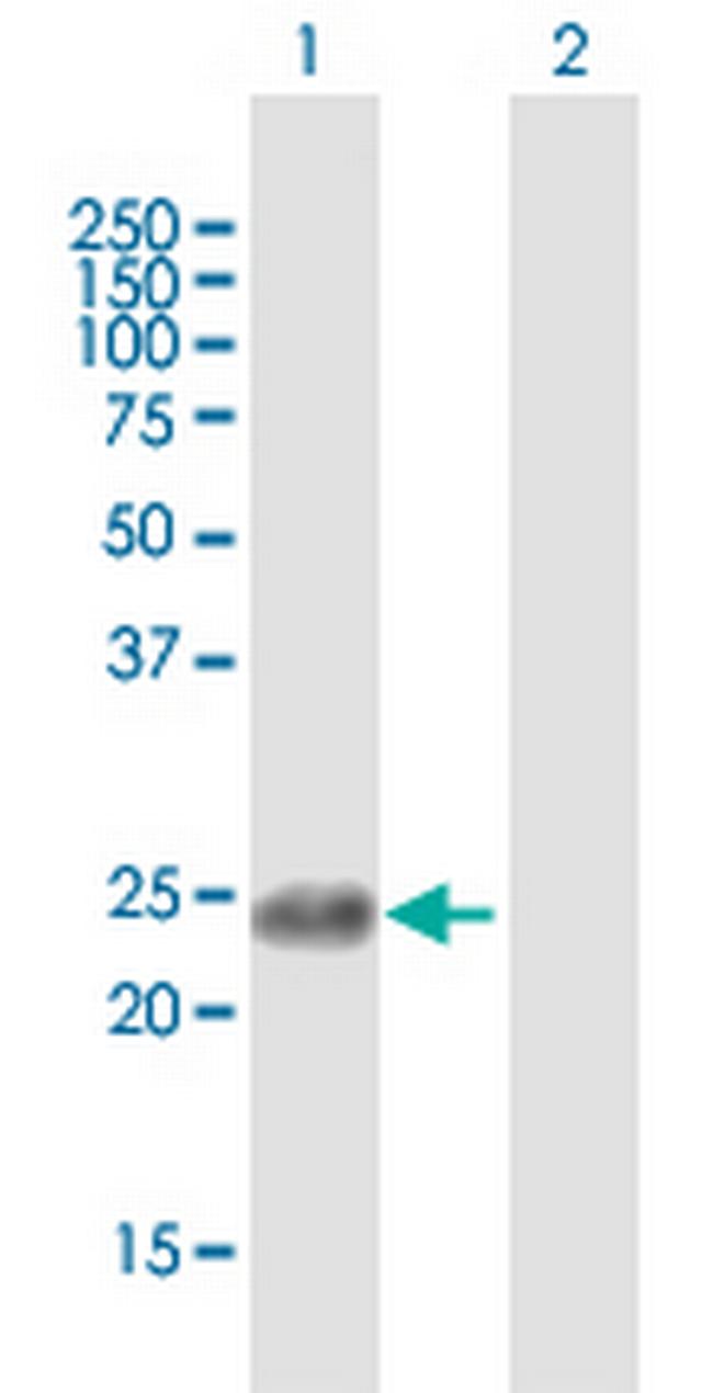 APOBEC3B Antibody in Western Blot (WB)