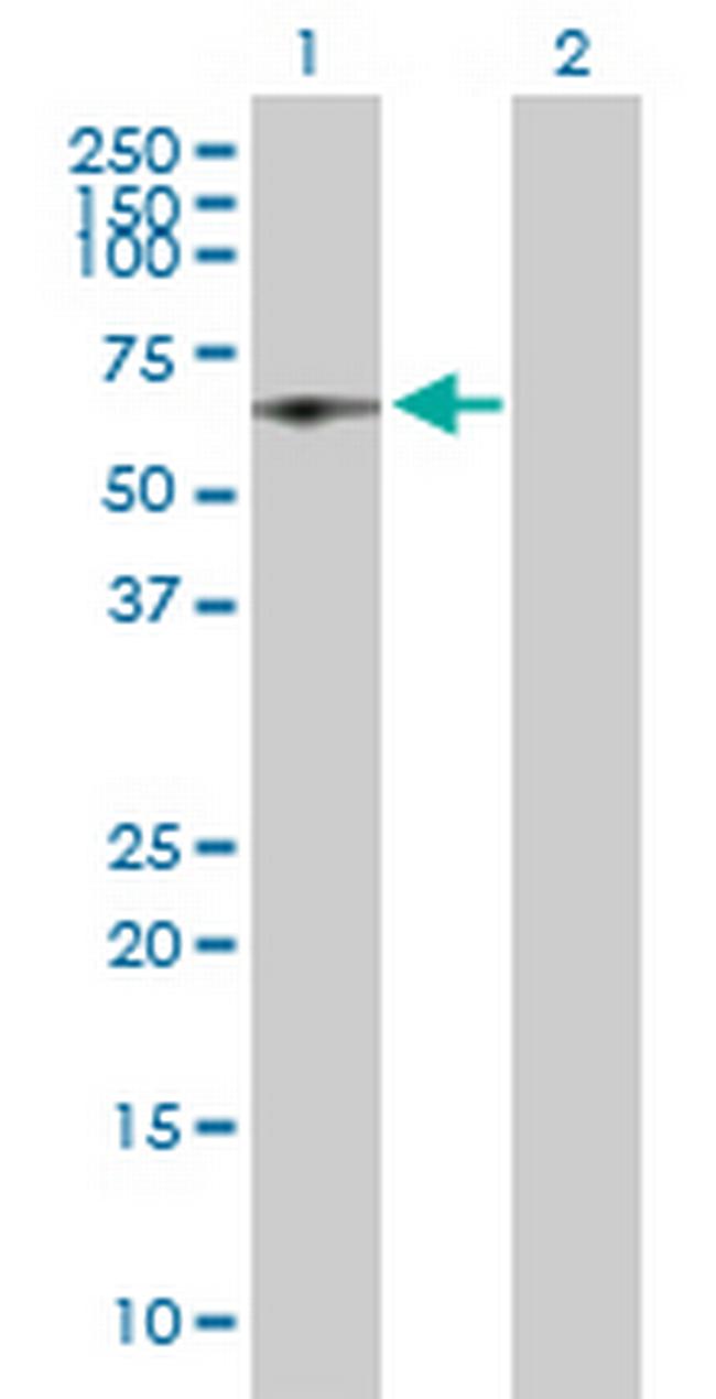 RBM39 Antibody in Western Blot (WB)