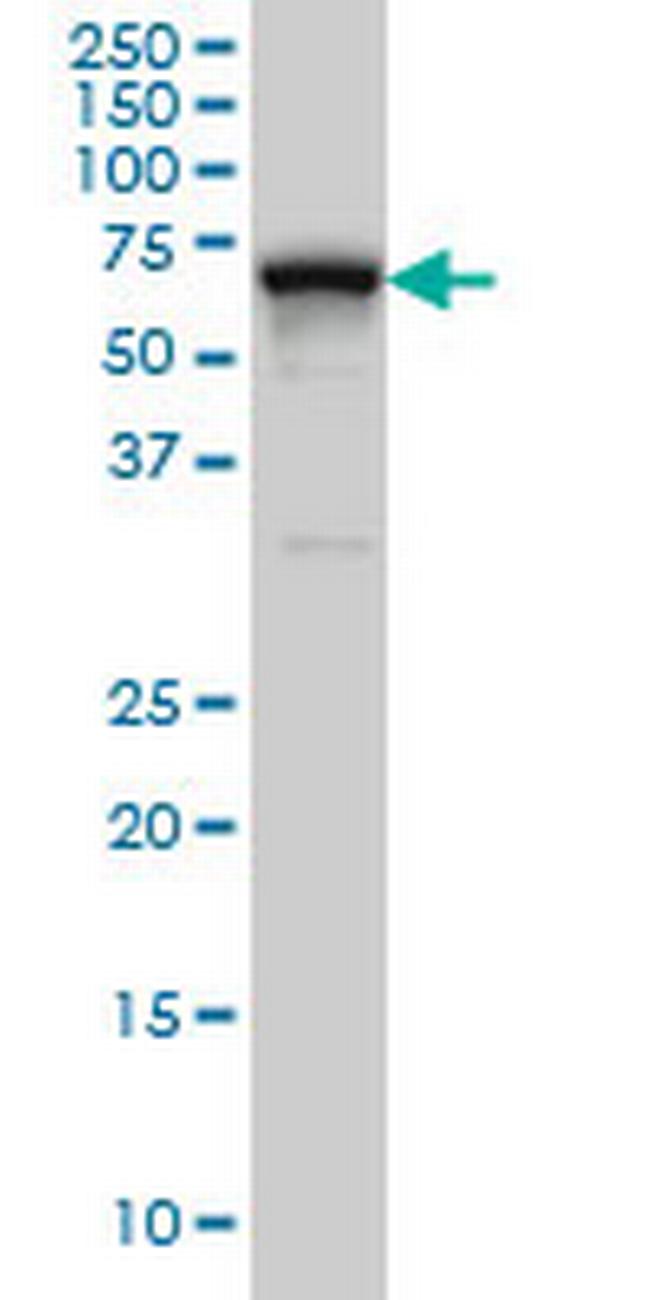 RNPC2 Antibody in Western Blot (WB)