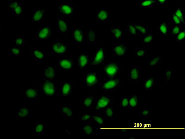 CREB5 Antibody in Immunocytochemistry (ICC/IF)