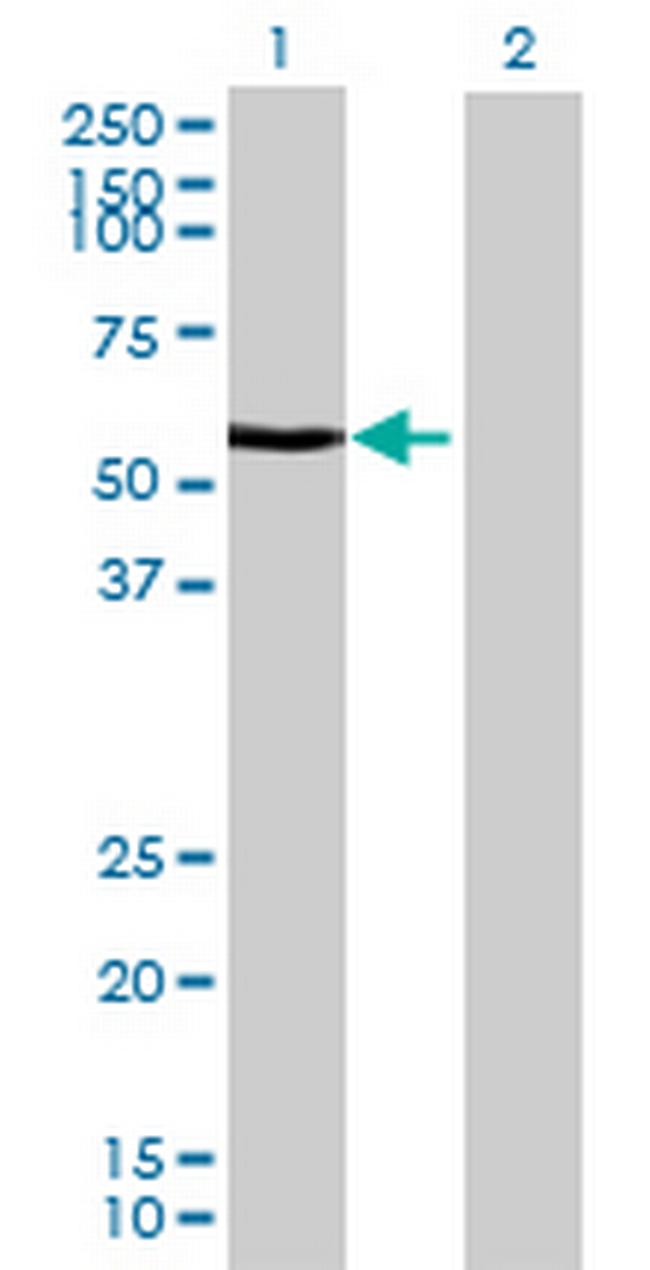 WTAP Antibody in Western Blot (WB)