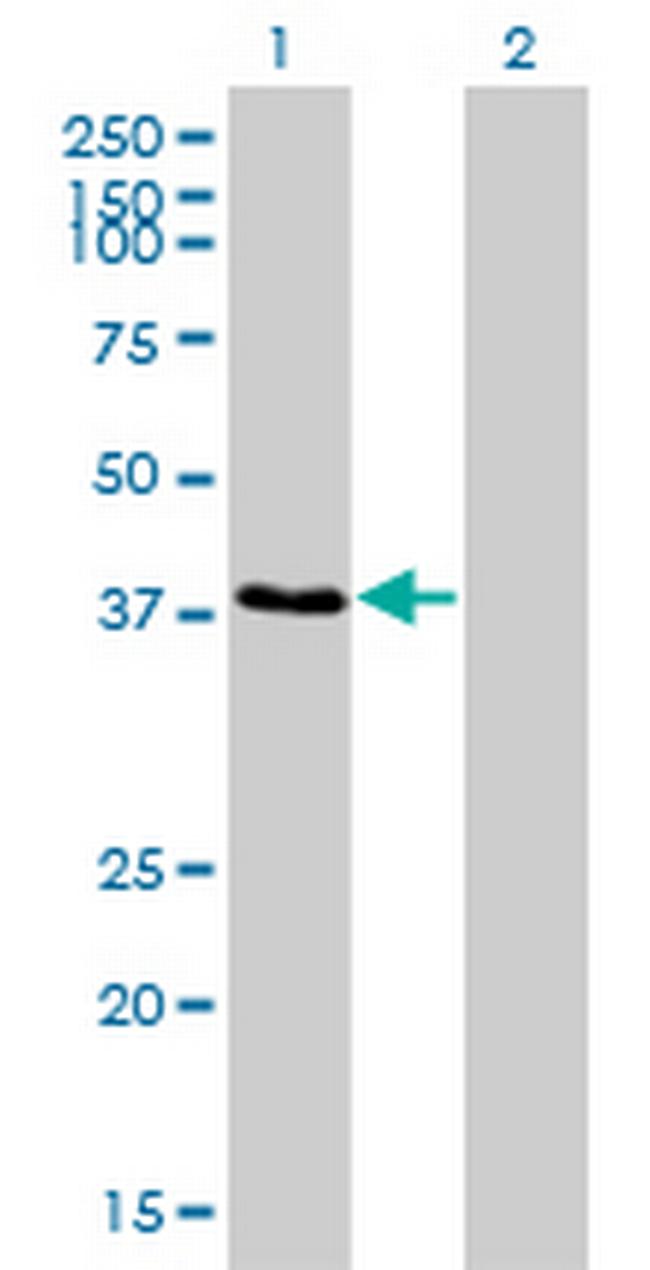RNF14 Antibody in Western Blot (WB)