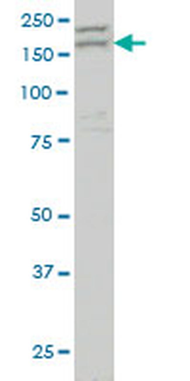 AATK Antibody in Western Blot (WB)