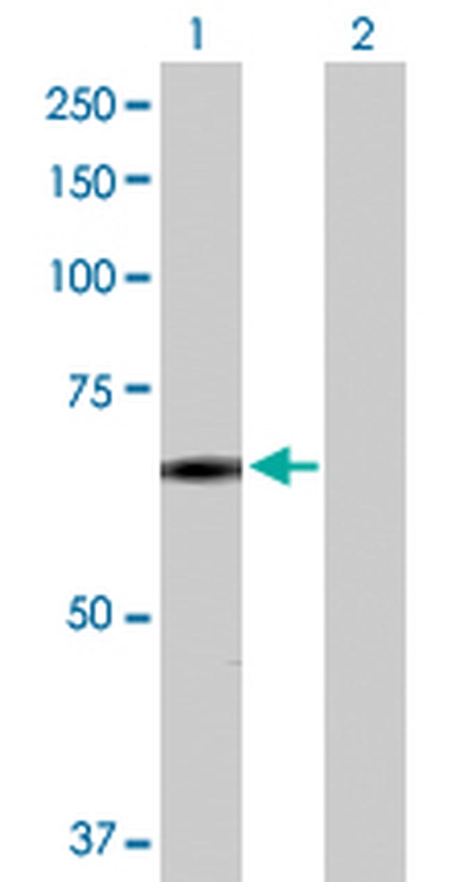 SNCAIP Antibody in Western Blot (WB)