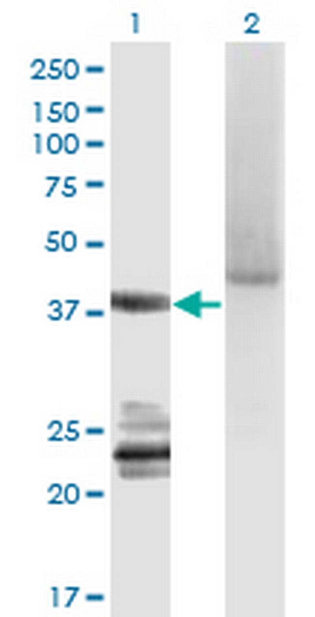 GNA14 Antibody in Western Blot (WB)