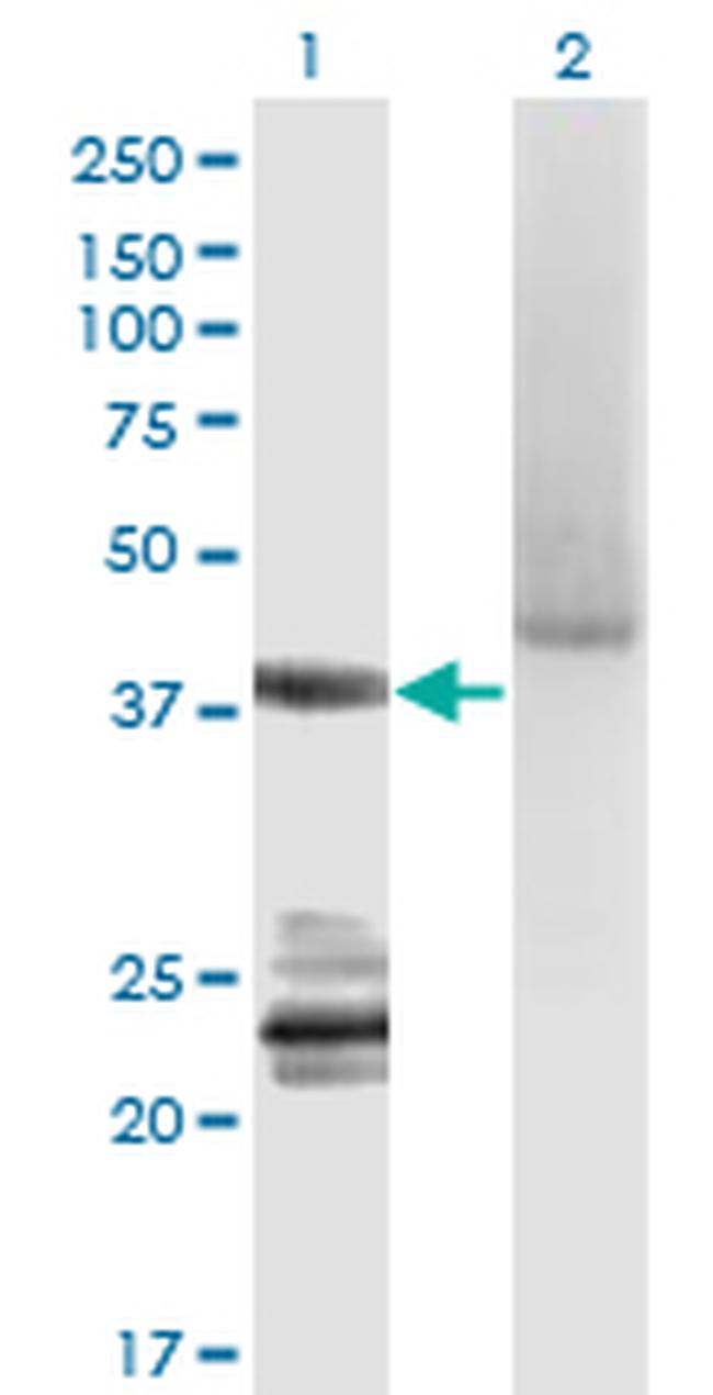 GNA14 Antibody in Western Blot (WB)