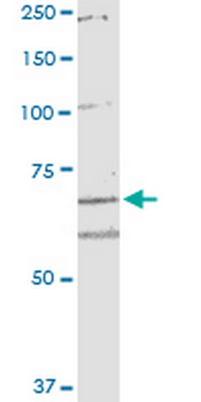 ARHGEF10 Antibody in Western Blot (WB)