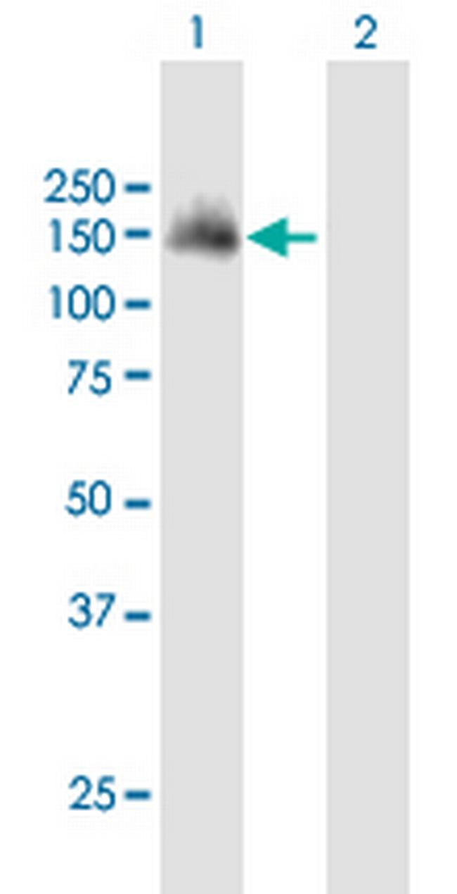 SH3PXD2A Antibody in Western Blot (WB)