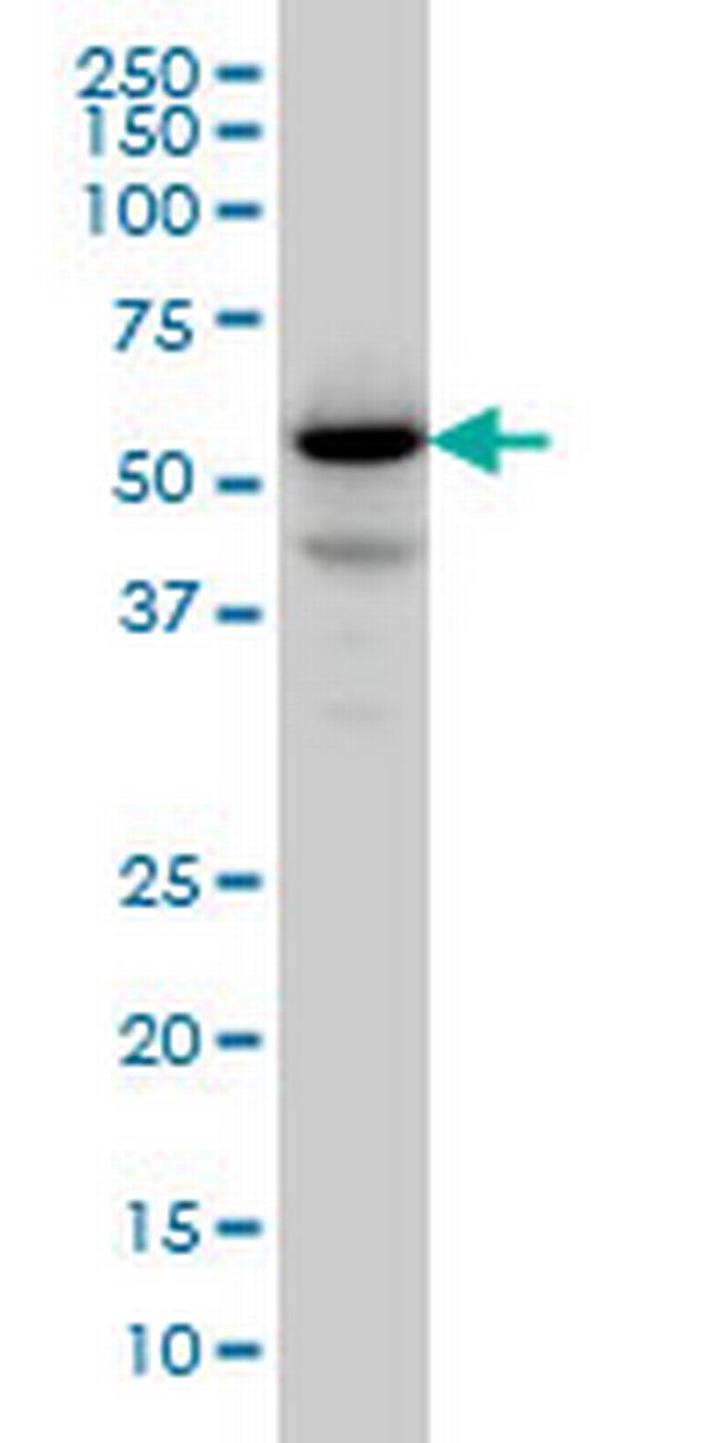 PPM1F Antibody in Western Blot (WB)