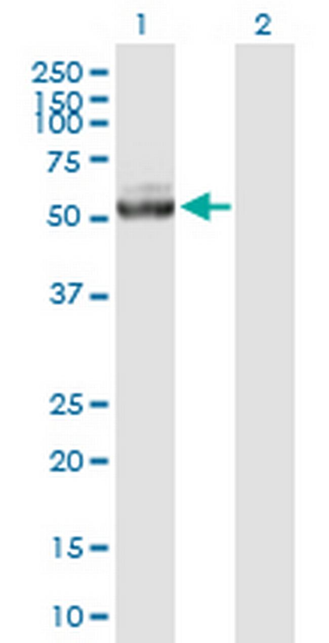 IQCB1 Antibody in Western Blot (WB)
