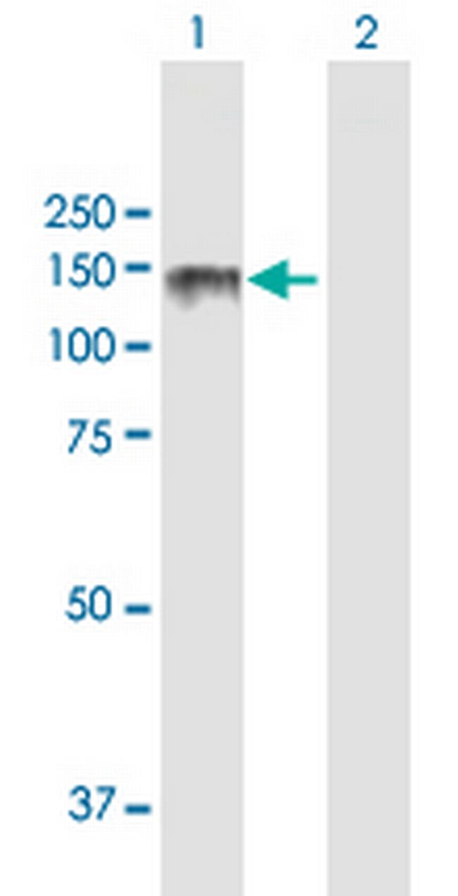 LPIN2 Antibody in Western Blot (WB)