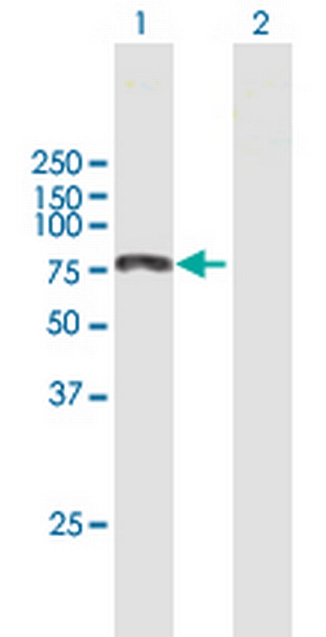 KIAA0430 Antibody in Western Blot (WB)
