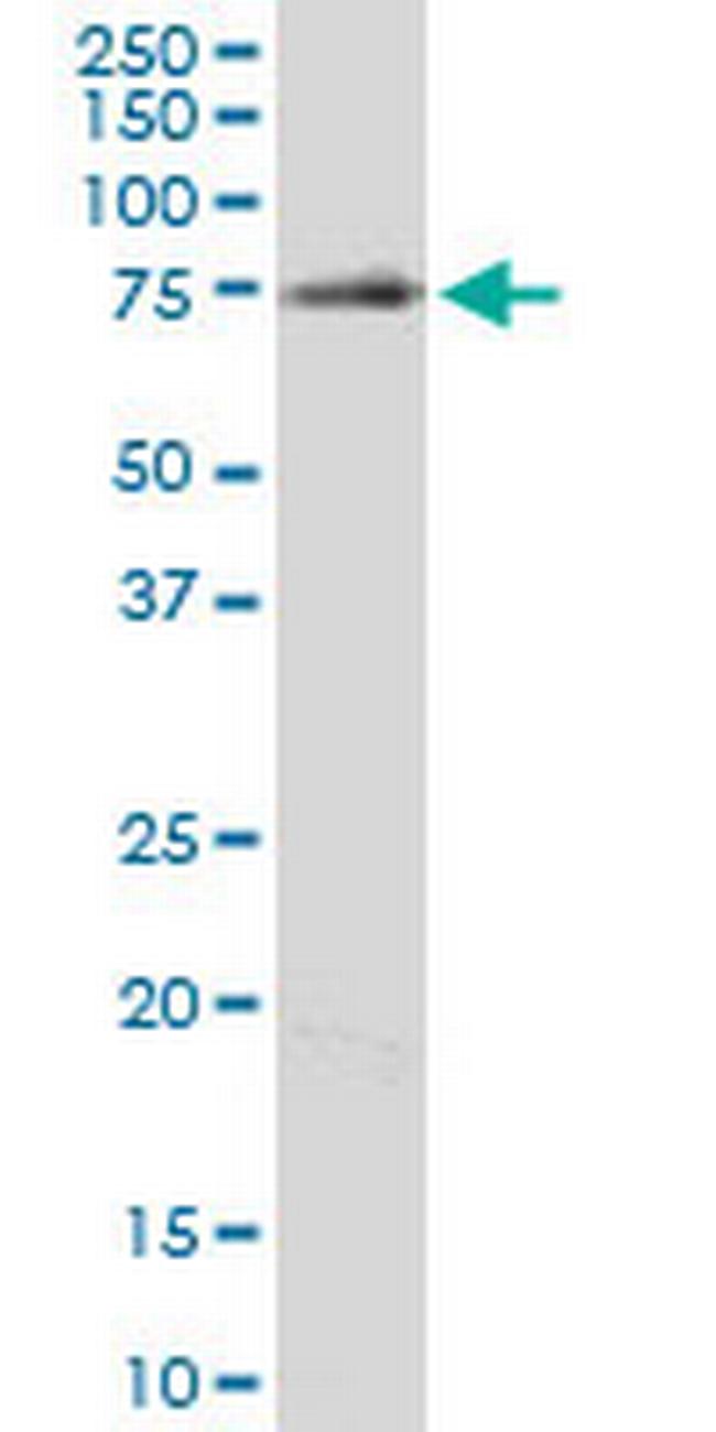 ENTH Antibody in Western Blot (WB)