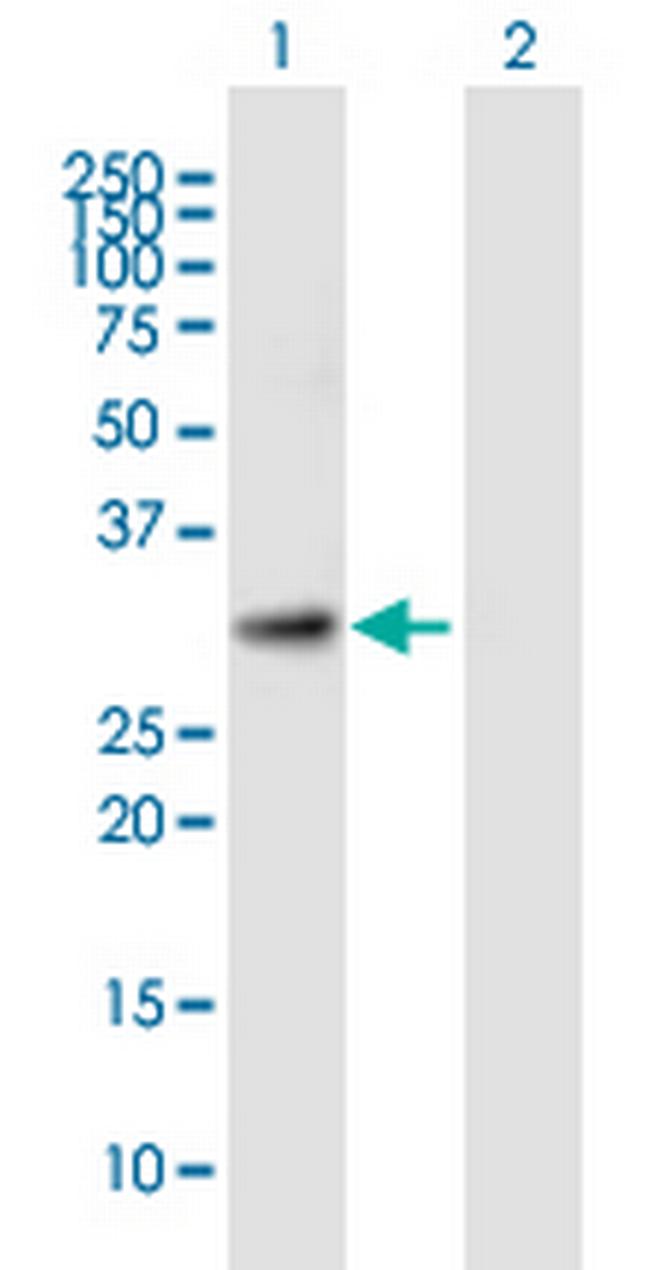 KIAA0103 Antibody in Western Blot (WB)