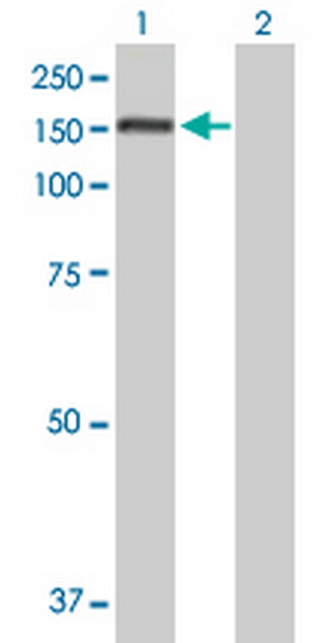 PUM1 Antibody in Western Blot (WB)