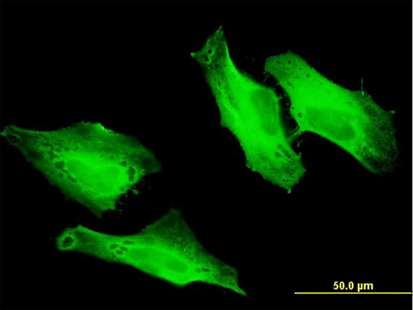 CEP57 Antibody in Immunocytochemistry (ICC/IF)