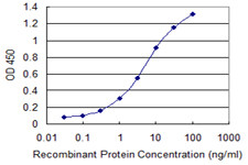 ULK2 Antibody in ELISA (ELISA)