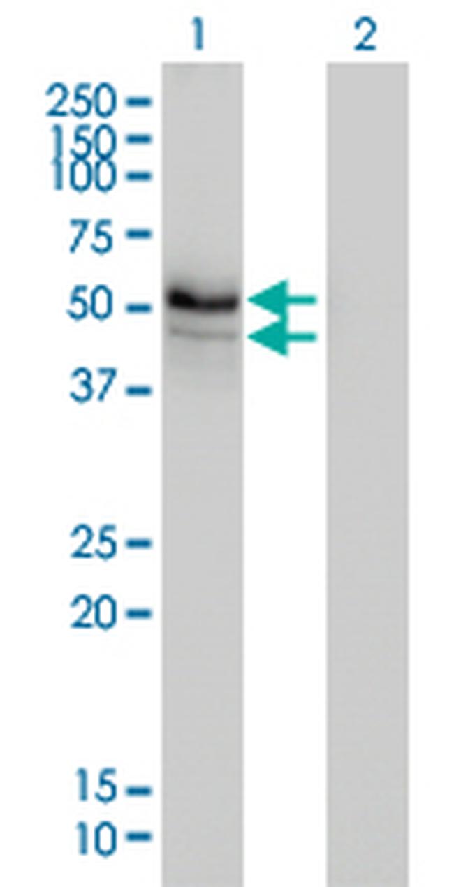 HERPUD1 Antibody in Western Blot (WB)