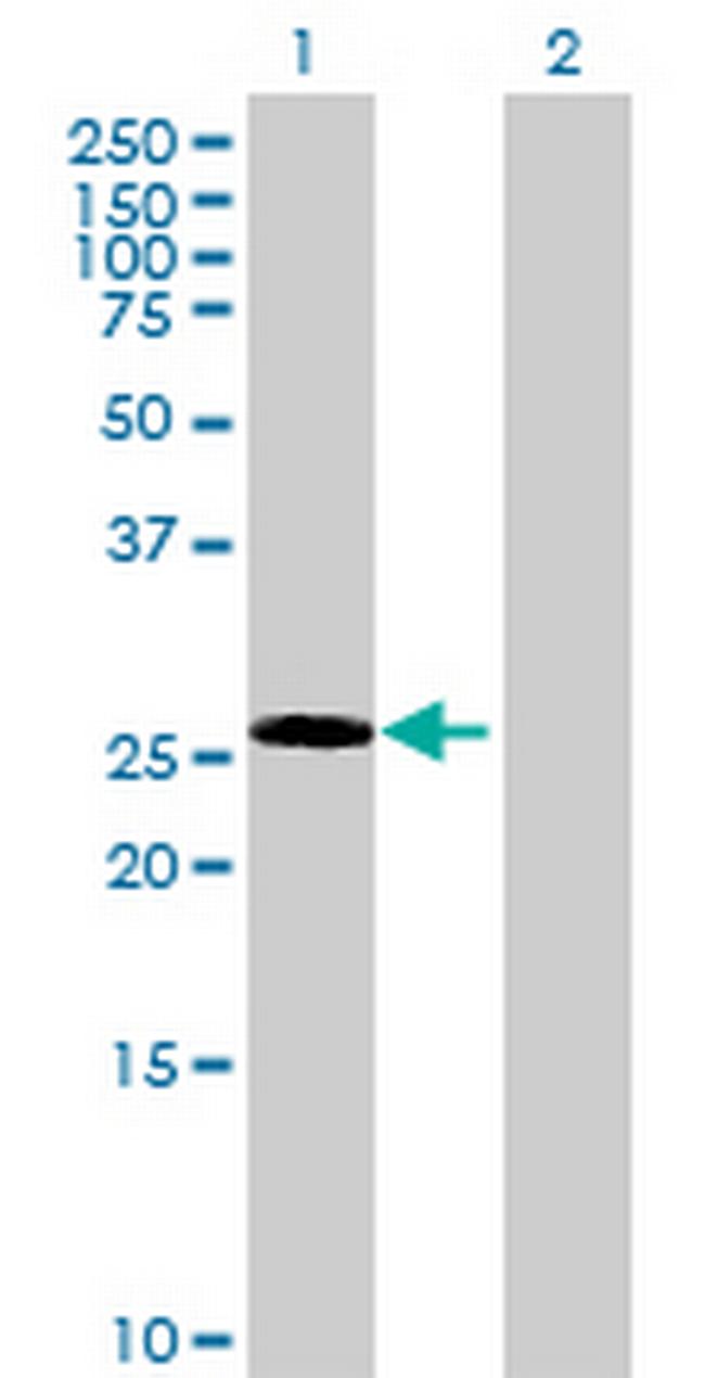 ECE2 Antibody in Western Blot (WB)