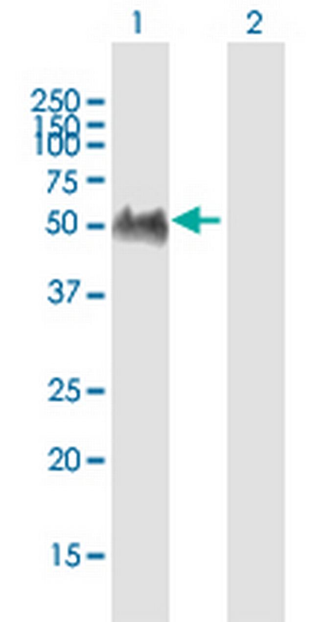 GPRIN2 Antibody in Western Blot (WB)