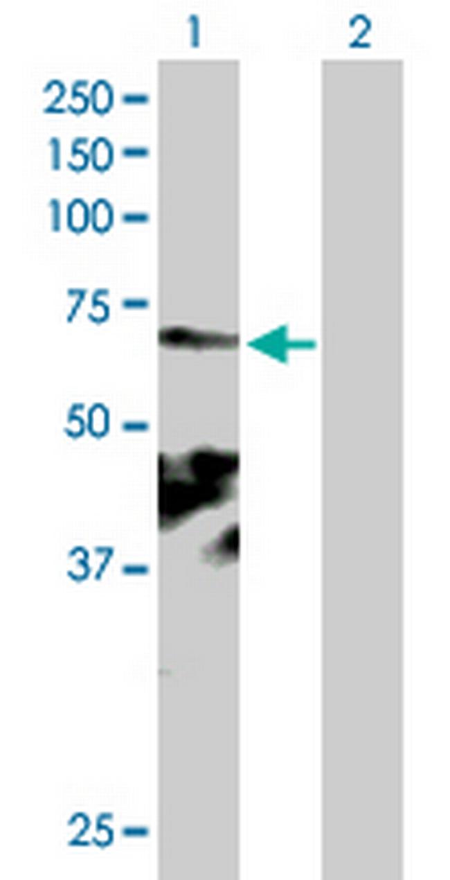 KIAA0562 Antibody in Western Blot (WB)