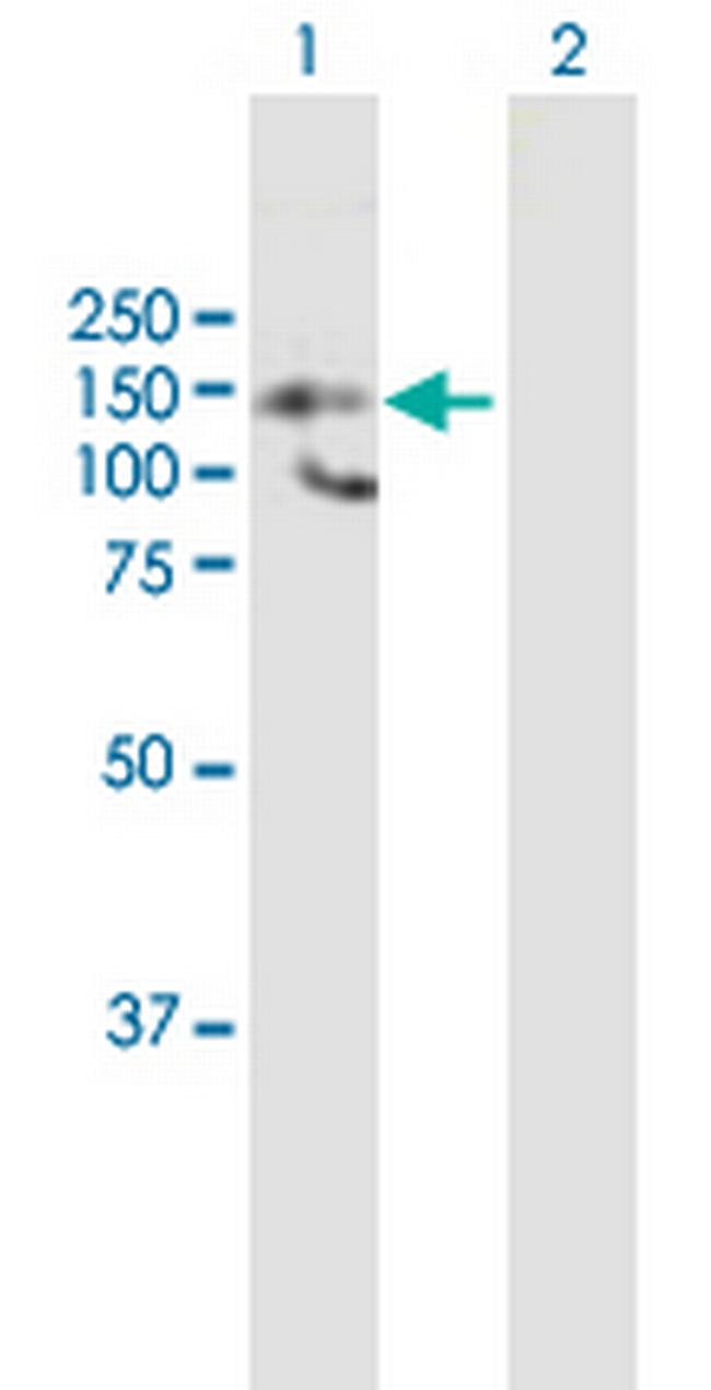 HDAC9 Antibody in Western Blot (WB)