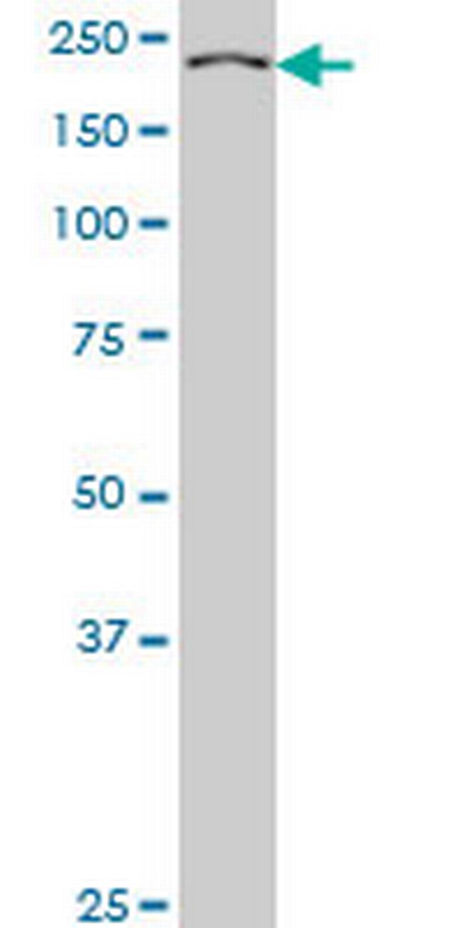 KNTC1 Antibody in Western Blot (WB)