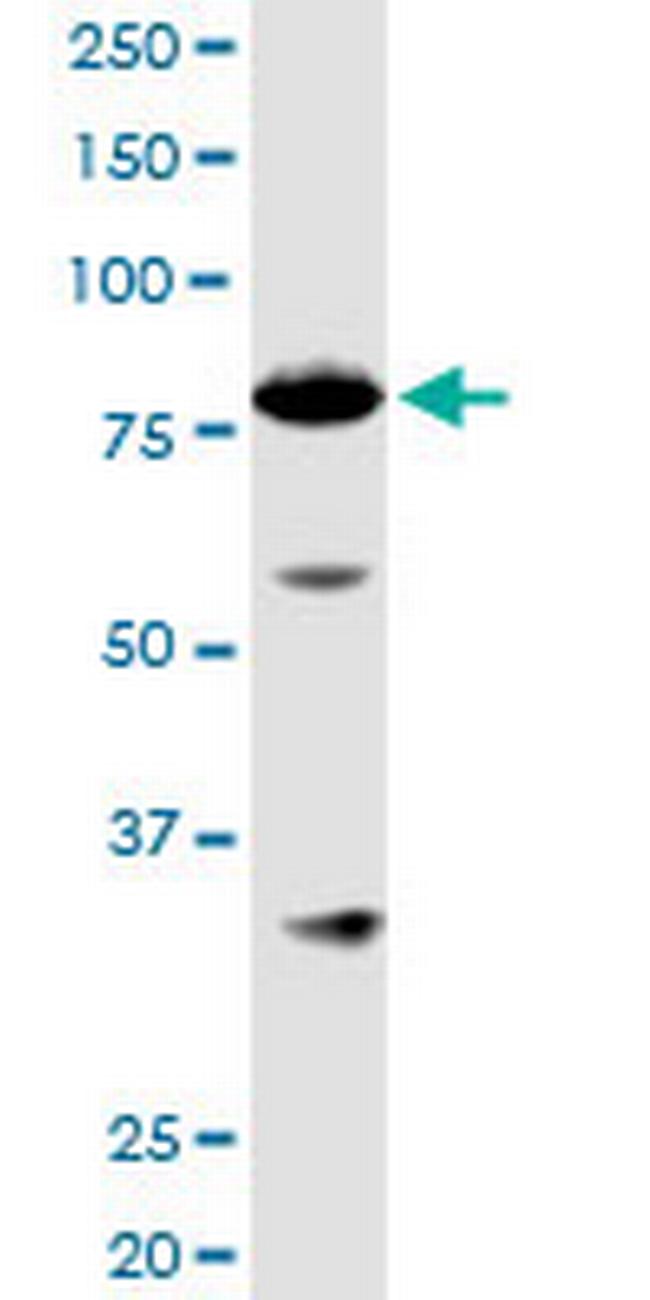 ACAP1 Antibody in Western Blot (WB)