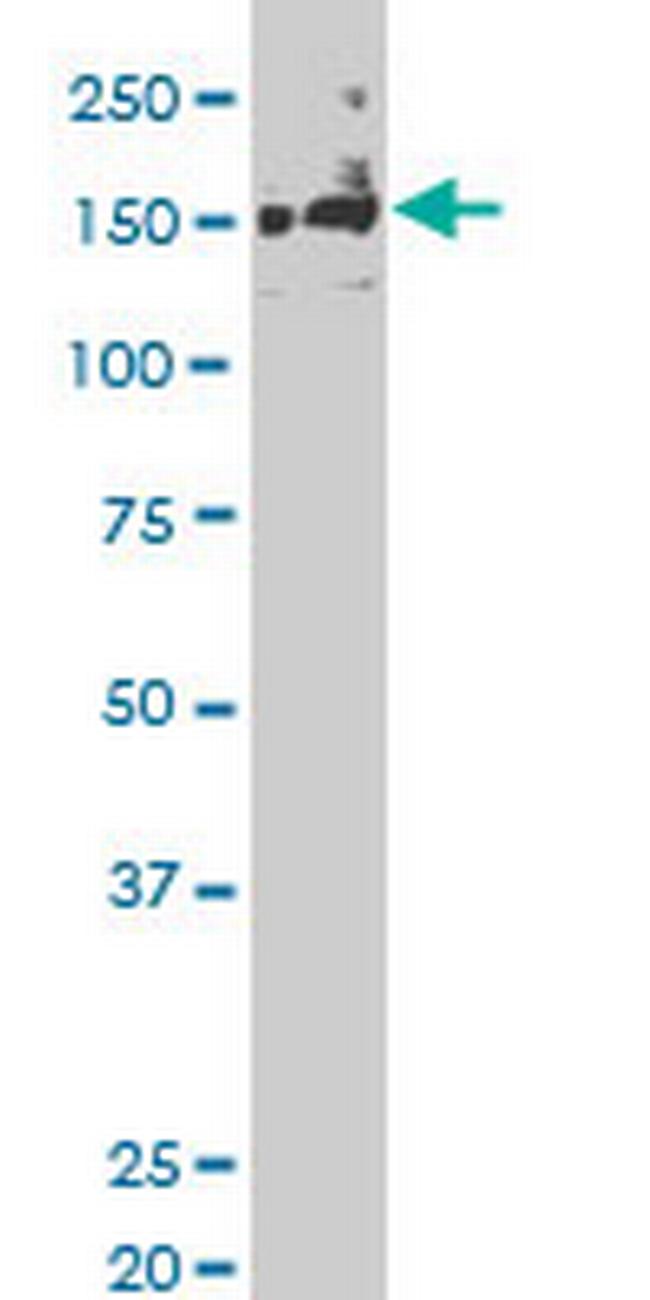 SLK Antibody in Western Blot (WB)